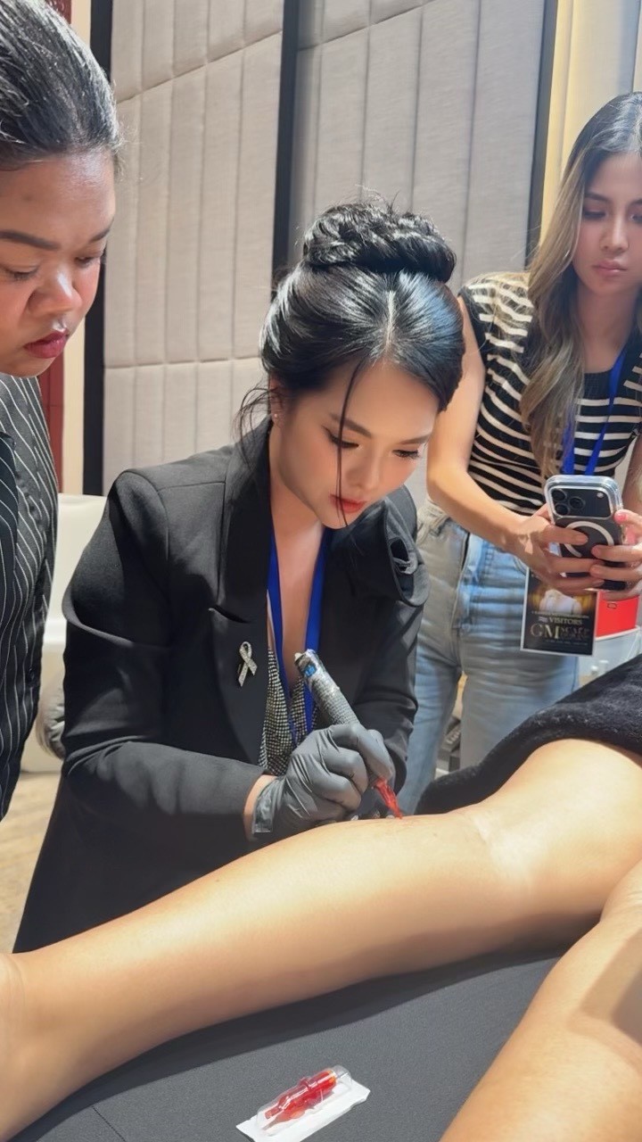 การรักษารอยแตกลายด้วย Microneedle